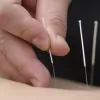 Innerchi Acupuncture