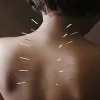 Northfield Acupuncture Clinic