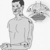 Emerald Gate Acupuncture