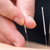 Kim's Acupuncture