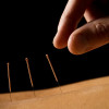 Sundo Acupuncture